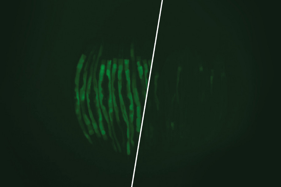 Mikroskopbild von C. elegans-Würmer zeigen in dem links abgebildeten Krankheitsmodell eine Stressreaktion, die grün zu sehen ist. Eine Zufuhr von Vitamin B12 gleicht diesen Effekt aus, wie rechts zu sehen ist.
