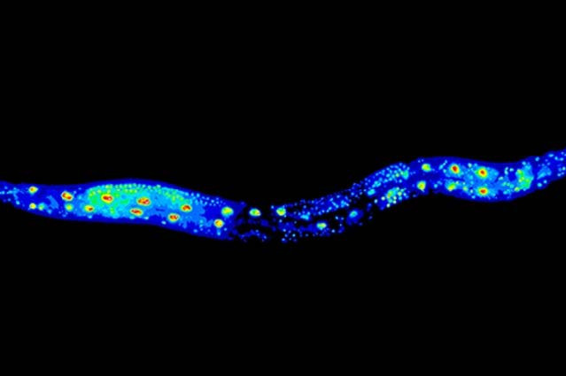 Der Rundwurm Caenorhabditis elegans ist ein wichtiger Modellorganismus in der Alterungsforschung. Der Wurm auf dem Bild ist mit GFP::RNP-6 markiert. 