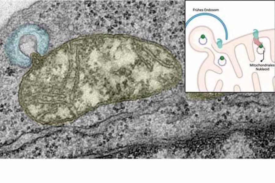 Elektronenmikroskopische Aufnahme der Nukleoid-Extraktion in einer Zelle und schematische Darstellung des neuen Mechanismus